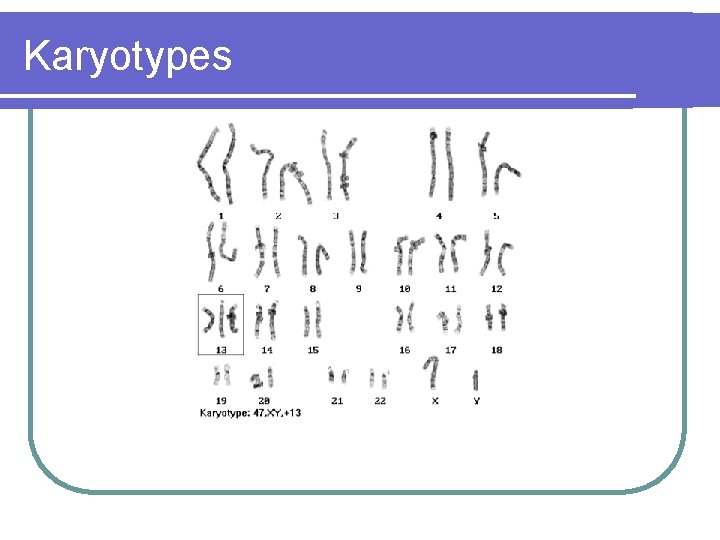 Karyotypes Karyotypes