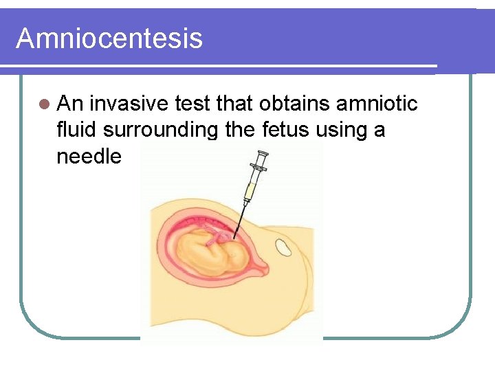 Amniocentesis l An invasive test that obtains amniotic fluid surrounding the fetus using a Amniocentesis l An invasive test that obtains amniotic fluid surrounding the fetus using a