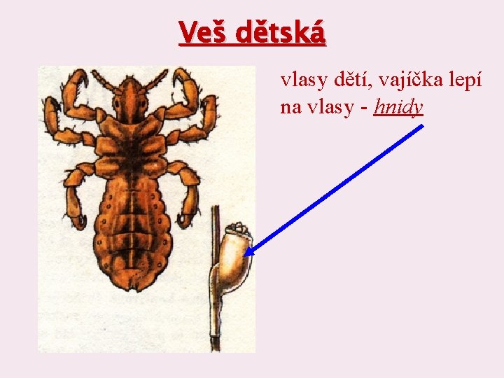 Veš dětská vlasy dětí, vajíčka lepí na vlasy - hnidy 