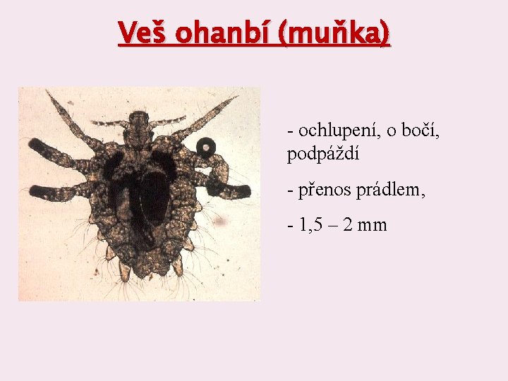 Veš ohanbí (muňka) - ochlupení, o bočí, podpáždí - přenos prádlem, - 1, 5