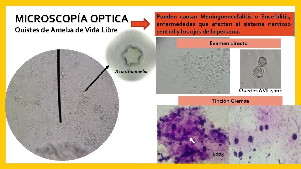 MICROSCOPÍA OPTICA Quistes de Ameba de Vida Libre Pueden causar Meningoencefalitis o Encefalitis, enfermedades