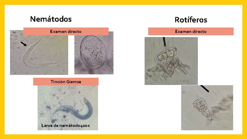 Nemátodos Examen directo Tinción Giemsa Larva de nemátodo 400 x Rotíferos Examen directo 