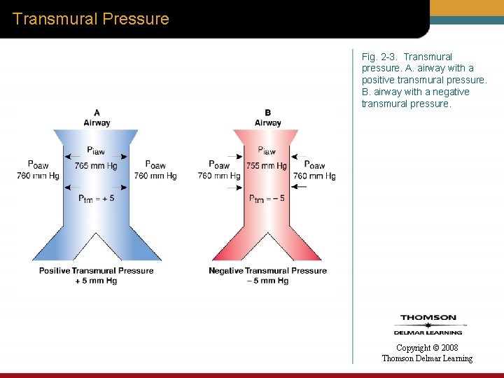 Transmural Pressure Fig. 2 -3. Transmural pressure. A. airway with a positive transmural pressure.