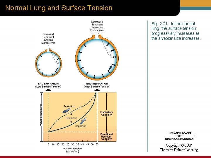 Normal Lung and Surface Tension Fig. 2 -21. In the normal lung, the surface