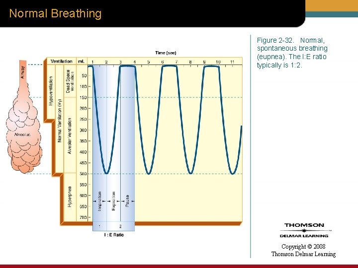 Normal Breathing Figure 2 -32. Normal, spontaneous breathing (eupnea). The I: E ratio typically