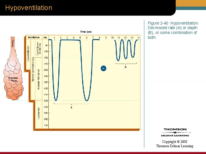 Hypoventilation Figure 2 -40 Hypoventilation. Decreased rate (A) or depth (B), or some combination