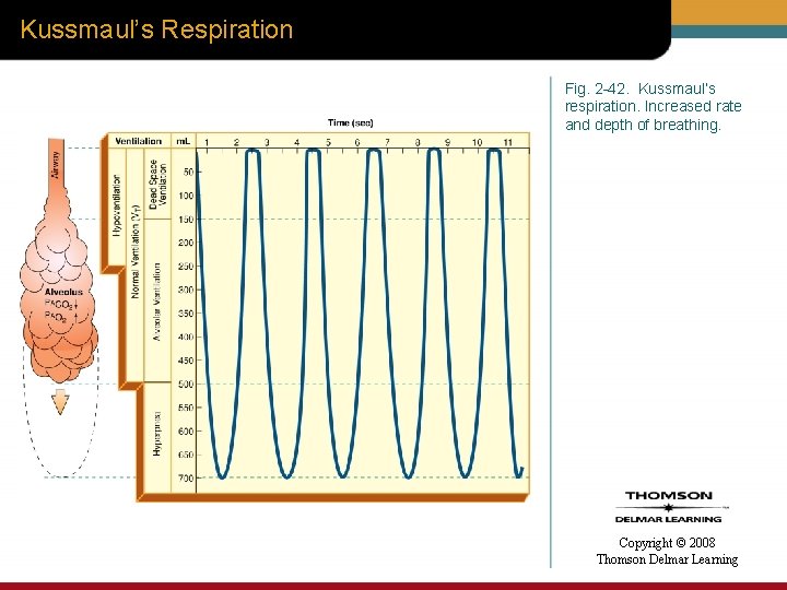 Kussmaul’s Respiration Fig. 2 -42. Kussmaul’s respiration. Increased rate and depth of breathing. Copyright