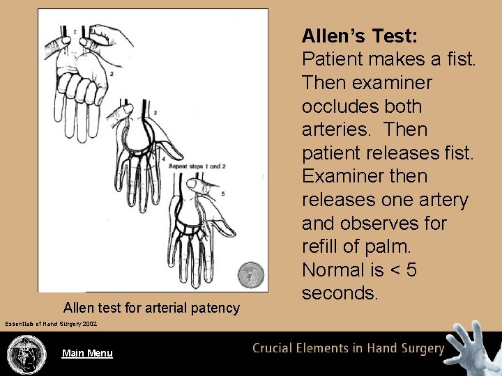 Allen test for arterial patency Essentials of Hand Surgery 2002 Main Menu Allen’s Test: