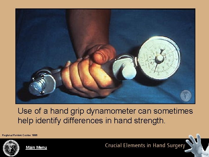 Use of a hand grip dynamometer can sometimes help identify differences in hand strength.