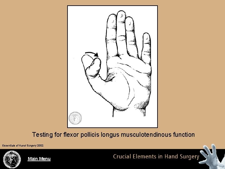 Testing for flexor pollicis longus musculotendinous function Essentials of Hand Surgery 2002 Main Menu