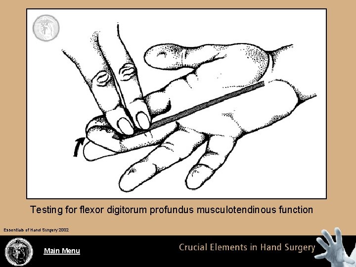 Testing for flexor digitorum profundus musculotendinous function Essentials of Hand Surgery 2002 Main Menu