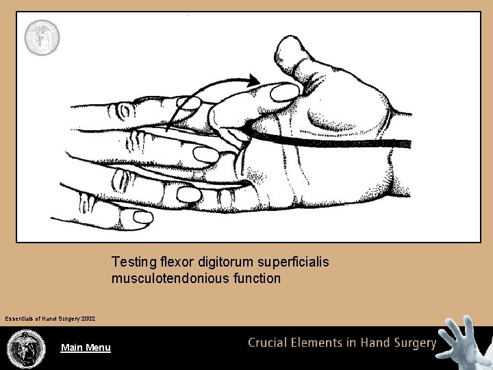 Testing flexor digitorum superficialis musculotendonious function Essentials of Hand Surgery 2002 Main Menu 