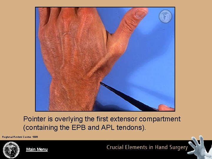 Pointer is overlying the first extensor compartment (containing the EPB and APL tendons). Regional