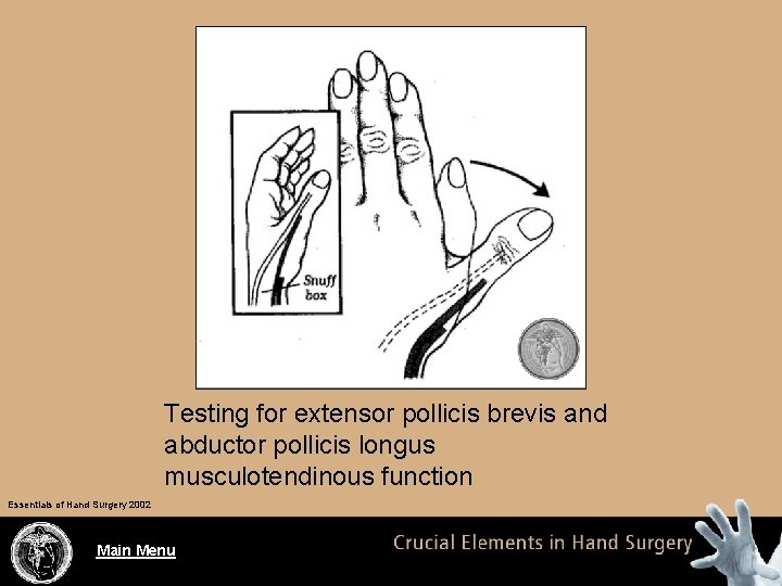 Testing for extensor pollicis brevis and abductor pollicis longus musculotendinous function Essentials of Hand