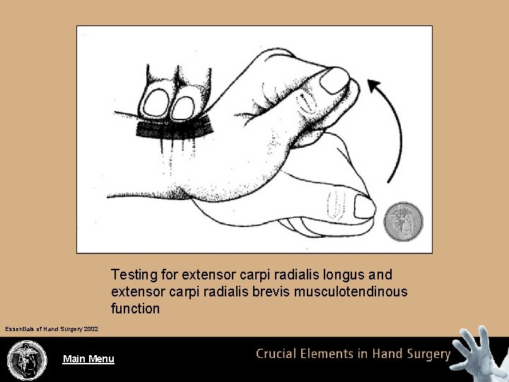 Testing for extensor carpi radialis longus and extensor carpi radialis brevis musculotendinous function Essentials