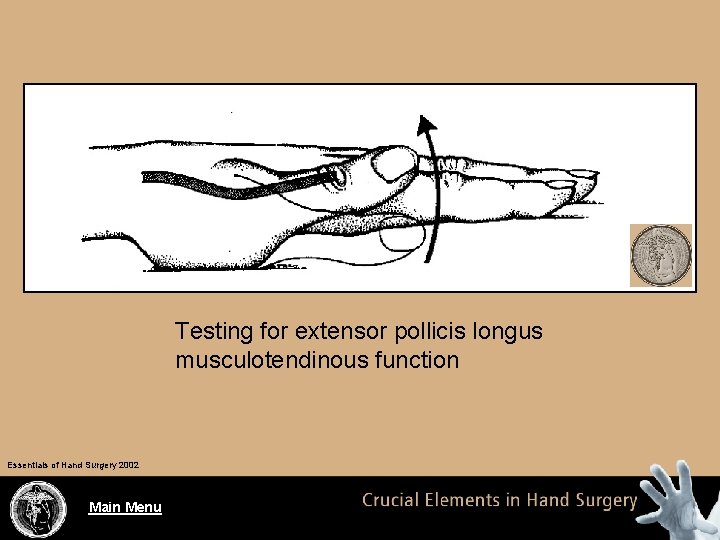 Testing for extensor pollicis longus musculotendinous function Essentials of Hand Surgery 2002 Main Menu