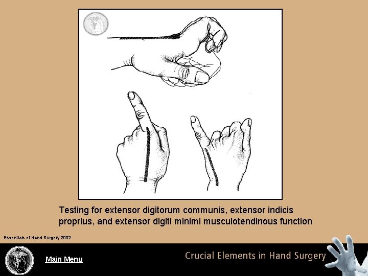 Testing for extensor digitorum communis, extensor indicis proprius, and extensor digiti minimi musculotendinous function