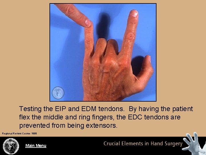 Testing the EIP and EDM tendons. By having the patient flex the middle and