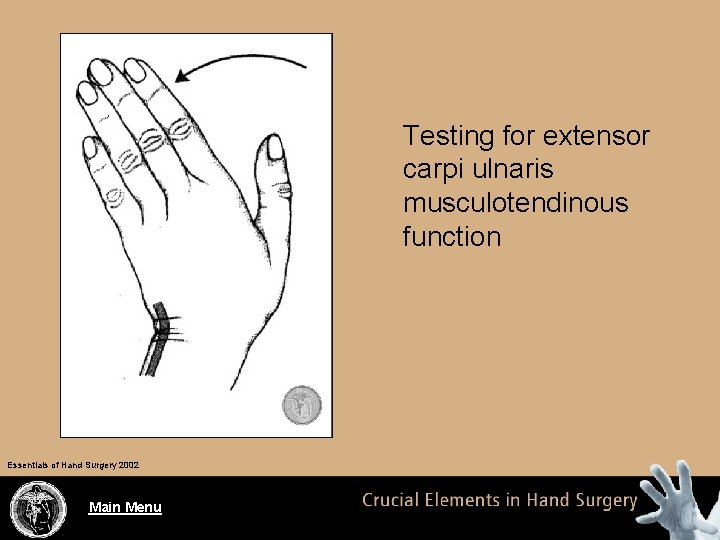 Testing for extensor carpi ulnaris musculotendinous function Essentials of Hand Surgery 2002 Main Menu