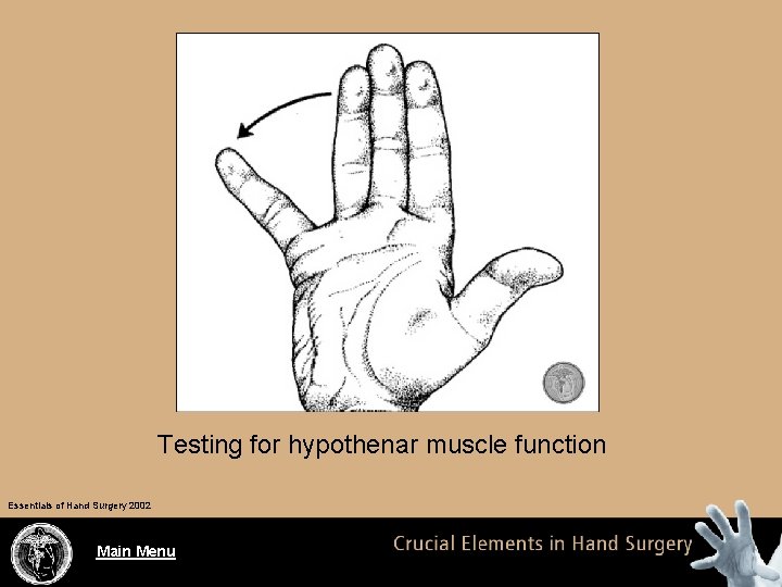 Testing for hypothenar muscle function Essentials of Hand Surgery 2002 Main Menu 