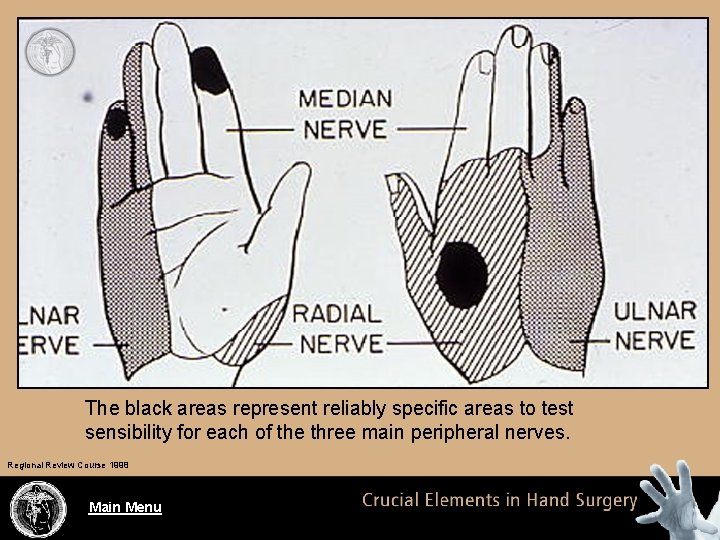 The black areas represent reliably specific areas to test sensibility for each of the