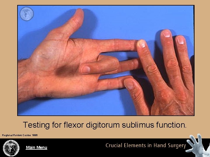 Testing for flexor digitorum sublimus function. Regional Review Course 1998 Main Menu 