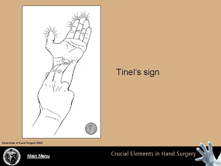 Tinel’s sign Essentials of Hand Surgery 2002 Main Menu 
