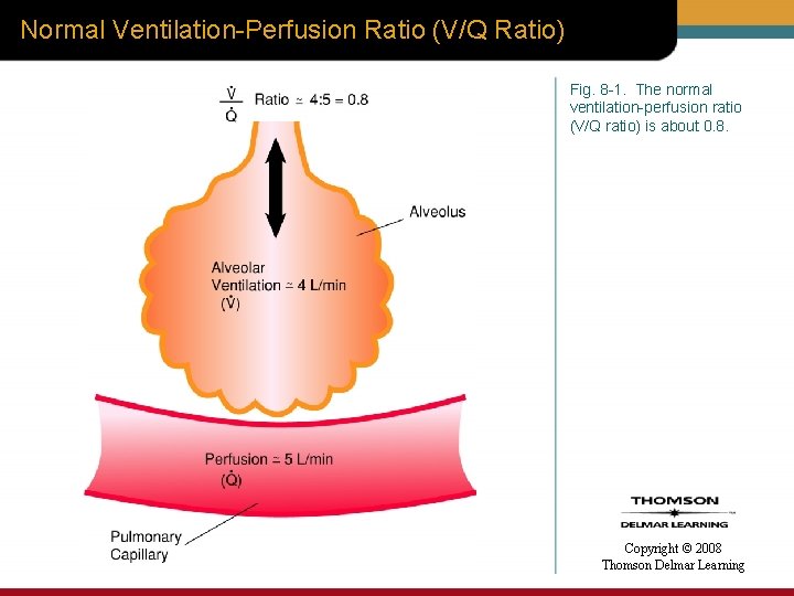 Normal Ventilation-Perfusion Ratio (V/Q Ratio) Fig. 8 -1. The normal ventilation-perfusion ratio (V/Q ratio)