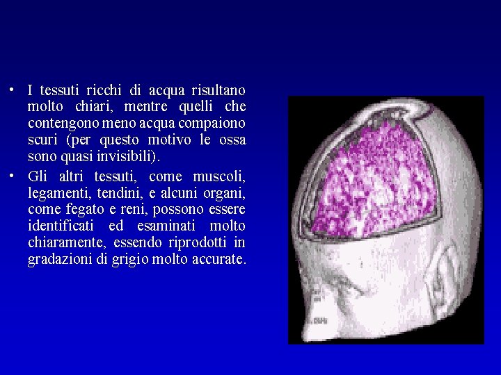  • I tessuti ricchi di acqua risultano molto chiari, mentre quelli che contengono