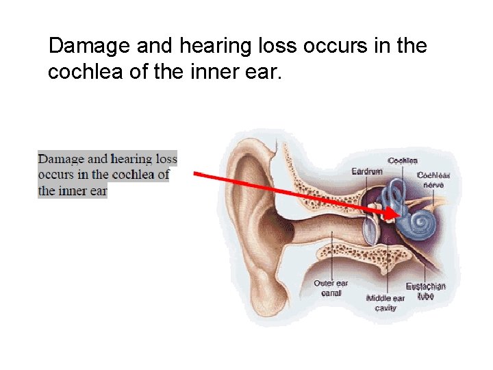 Damage and hearing loss occurs in the cochlea of the inner ear. 
