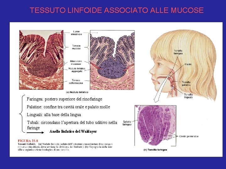 TESSUTO LINFOIDE ASSOCIATO ALLE MUCOSE Faringea: postero superiore del rinofaringe Palatine: confine tra cavità