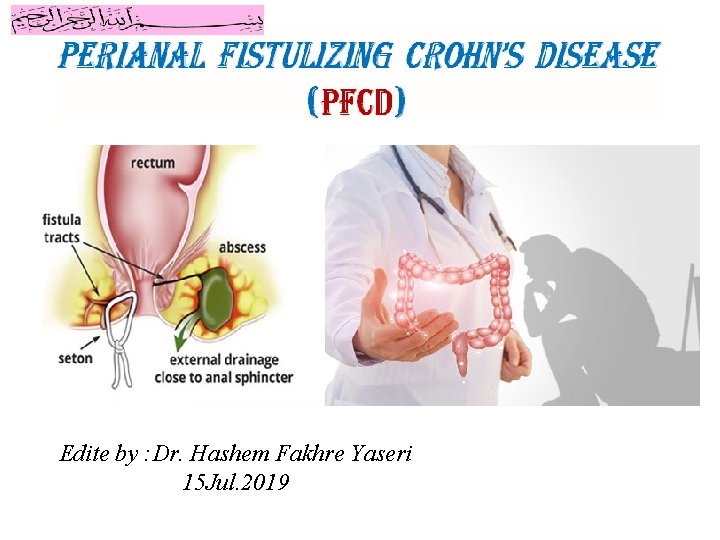 Edite by : Dr. Hashem Fakhre Yaseri 15 Jul. 2019 