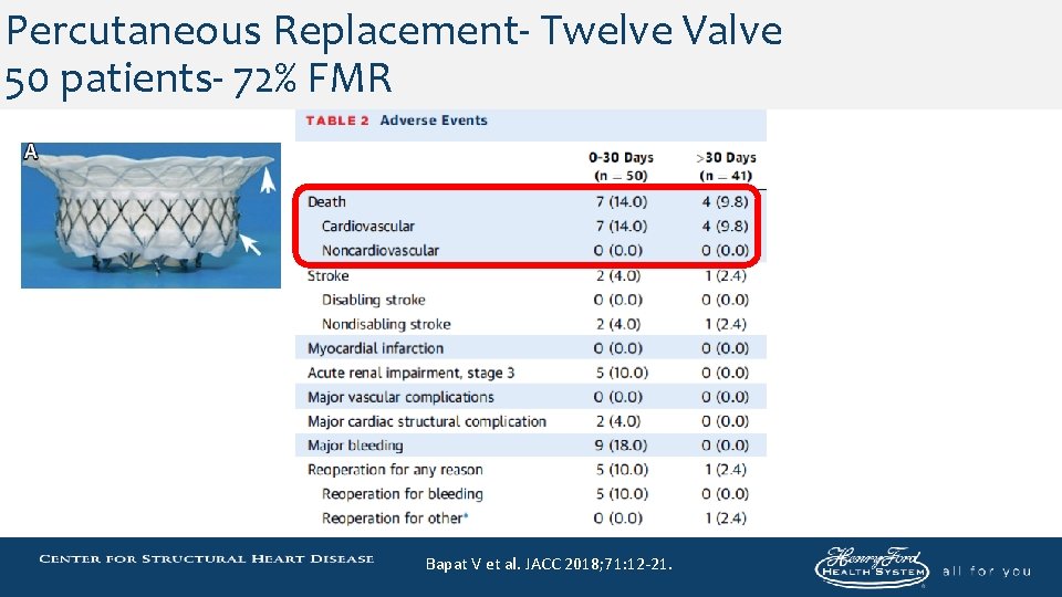 Percutaneous Replacement- Twelve Valve 50 patients- 72% FMR Bapat V et al. JACC 2018;