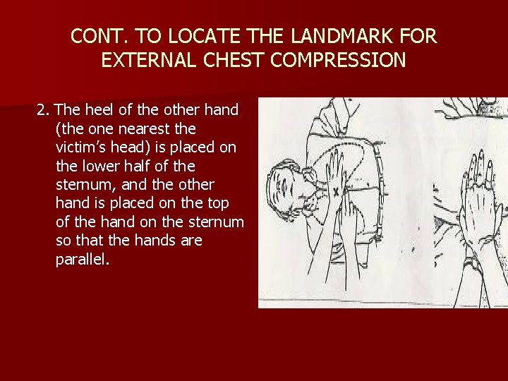 CONT. TO LOCATE THE LANDMARK FOR EXTERNAL CHEST COMPRESSION 2. The heel of the