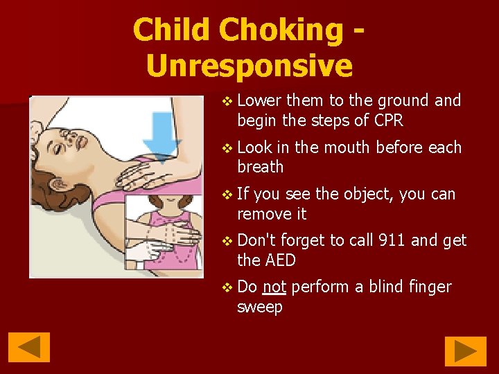 Child Choking Unresponsive v Lower them to the ground and begin the steps of