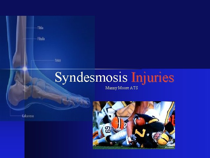 Syndesmosis Injuries Manny Moore ATS 