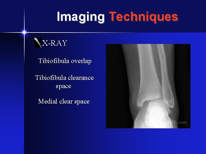 Syndesmosis Injuries Manny Moore ATS Syndesmosis Injuries 11