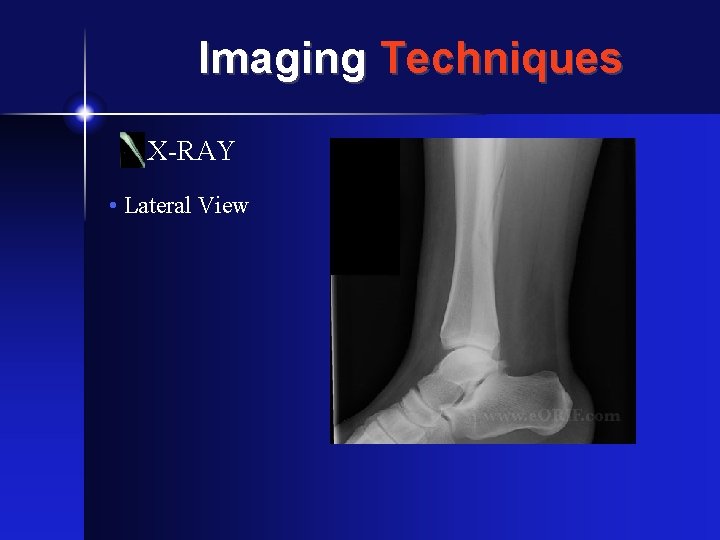 Imaging Techniques X-RAY • Lateral View 