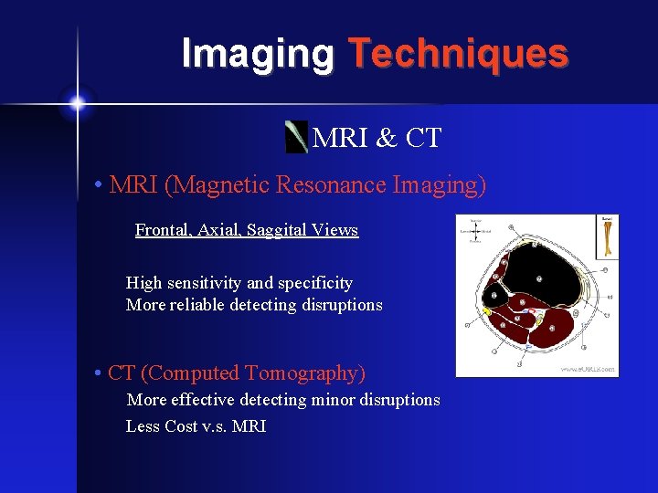 Imaging Techniques MRI & CT • MRI (Magnetic Resonance Imaging) Frontal, Axial, Saggital Views