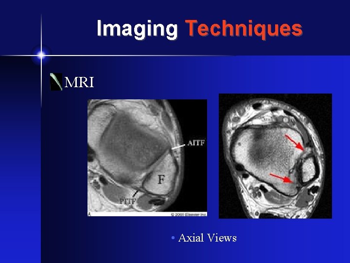 Imaging Techniques MRI • Axial Views 