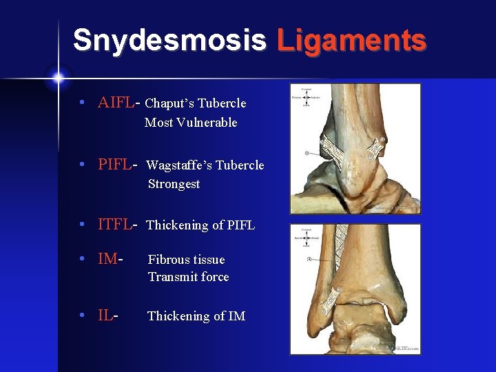 Snydesmosis Ligaments • AIFL- Chaput’s Tubercle Most Vulnerable • PIFL- Wagstaffe’s Tubercle Strongest •