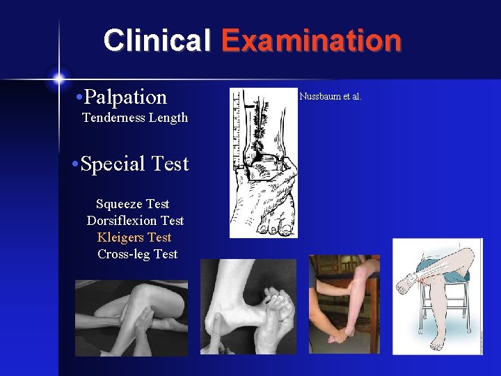 Clinical Examination • Palpation Tenderness Length • Special Test Squeeze Test Dorsiflexion Test Kleigers