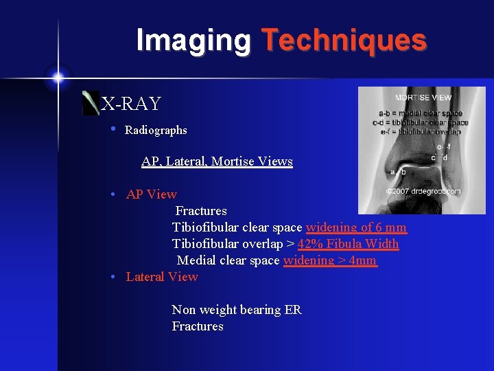 Imaging Techniques X-RAY • Radiographs AP, Lateral, Mortise Views • AP View Fractures Tibiofibular