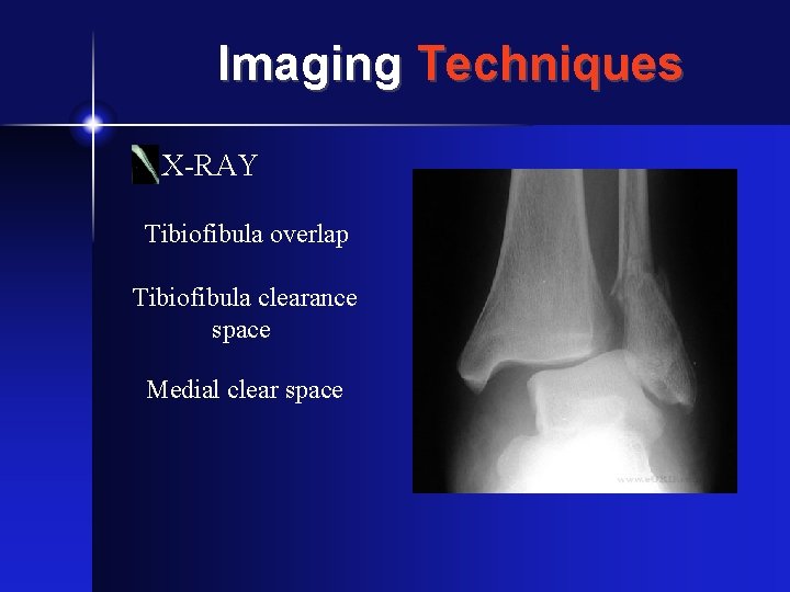 Imaging Techniques X-RAY Tibiofibula overlap Tibiofibula clearance space Medial clear space 