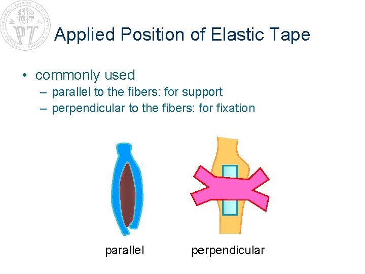 Applied Position of Elastic Tape • commonly used – parallel to the fibers: for