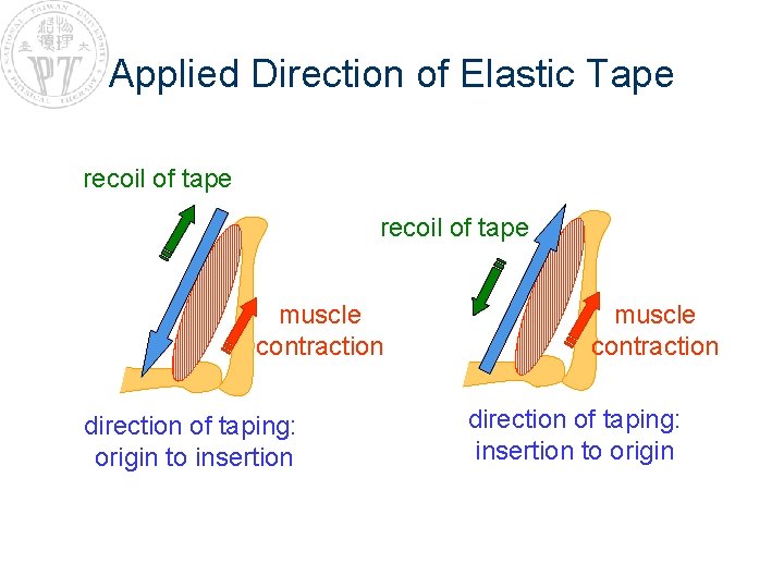 Applied Direction of Elastic Tape recoil of tape muscle contraction direction of taping: origin