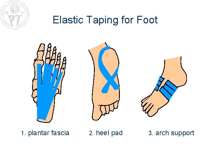 Elastic Taping for Foot 1. plantar fascia 2. heel pad 3. arch support 