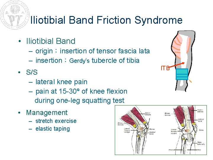 Iliotibial Band Friction Syndrome • Iliotibial Band – origin：insertion of tensor fascia lata –