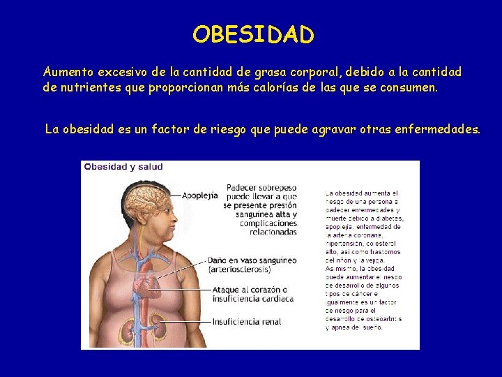 OBESIDAD Aumento excesivo de la cantidad de grasa corporal, debido a la cantidad de OBESIDAD Aumento excesivo de la cantidad de grasa corporal, debido a la cantidad de