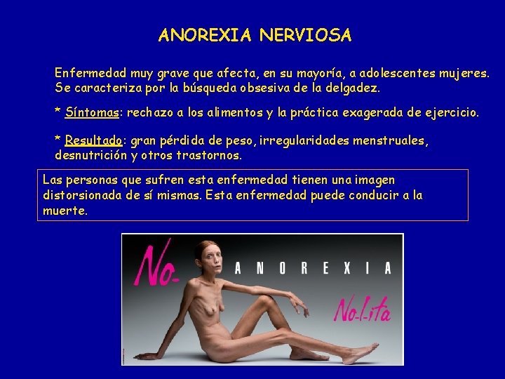 ANOREXIA NERVIOSA Enfermedad muy grave que afecta, en su mayoría, a adolescentes mujeres. Se ANOREXIA NERVIOSA Enfermedad muy grave que afecta, en su mayoría, a adolescentes mujeres. Se